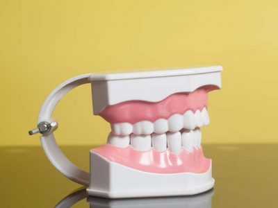 Periodontal-Treatment-Pristine-Dental