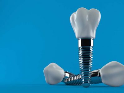 Prosthetic-Dentistry-Pristine-Dental